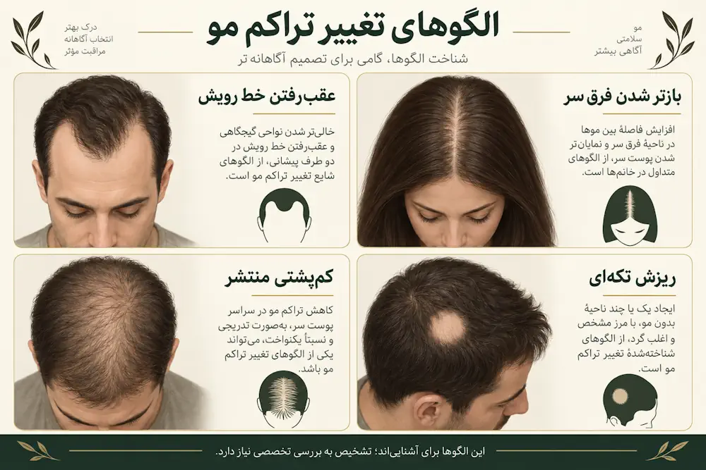 مقایسه تصویری الگوهای رایج ریزش مو و تغییر تراکم مو